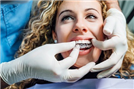 יישור שיניים - לכל שאלה תשובה
